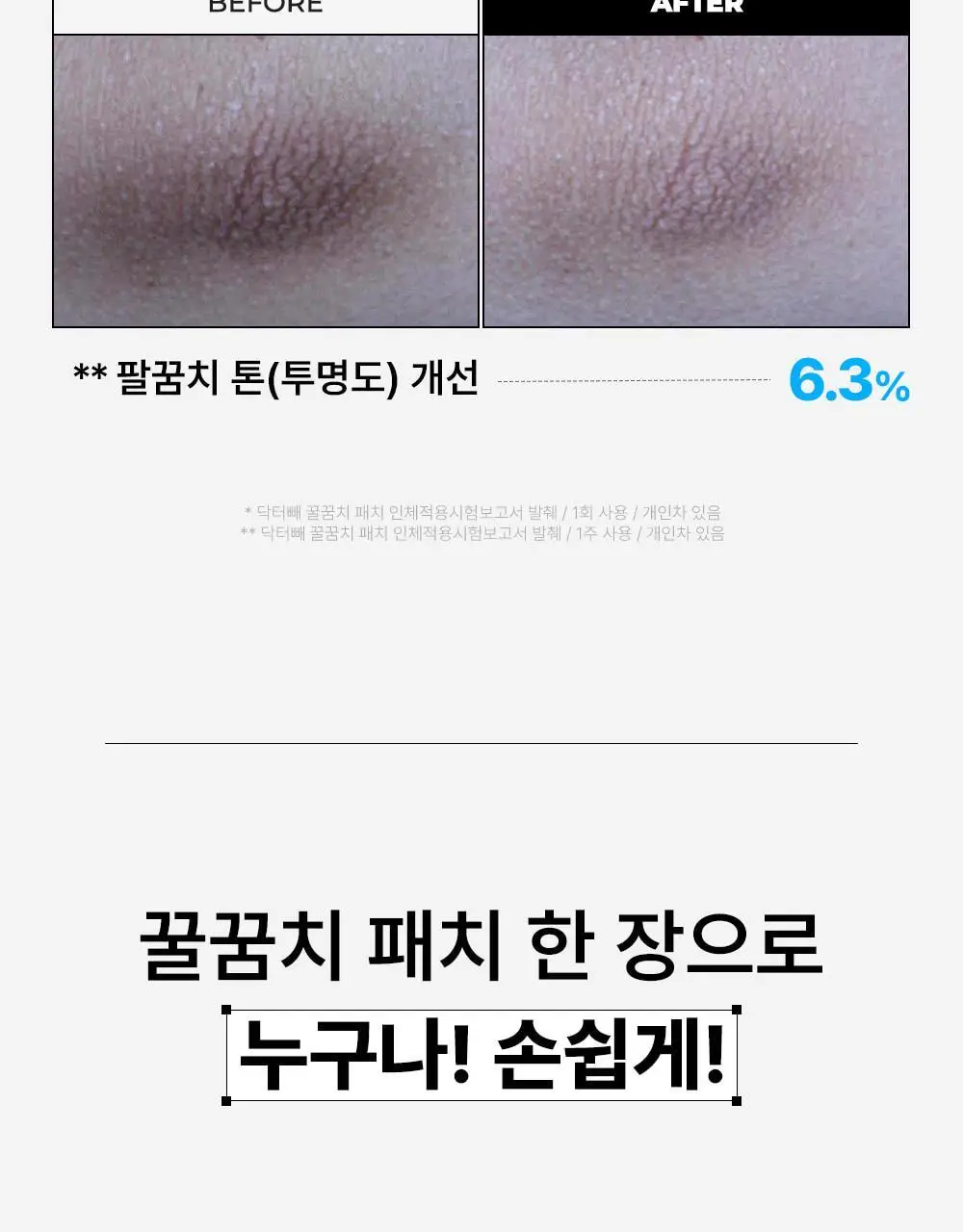 [NEW] 닥터빼 꿀꿈치 패치 1set * 4매 상세페이지 16